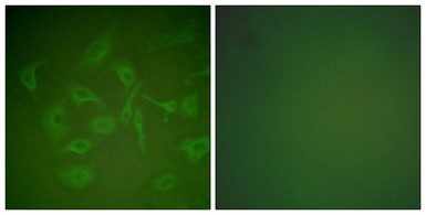 Mammaglobin A antibody