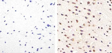 Tau (phospho Ser214) antibody