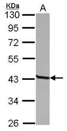 CD23 antibody [N3C3]