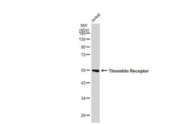 Thrombin Receptor antibody [N1