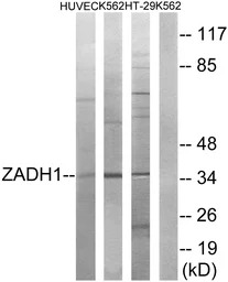 ZADH1 antibody