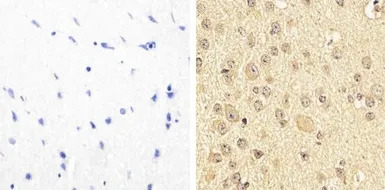 PYK2 (phospho Tyr579/Tyr580) a