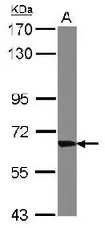 Transketolase antibody [N3C2],