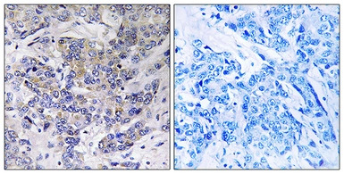 RPS21 antibody