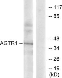 AGTR1 antibody