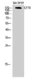 CFTR antibody