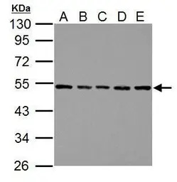 beta Tubulin antibody