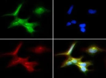 SSEA-1 / CD15 antibody [MC-480