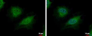 CSRP2BP antibody [N1N3]