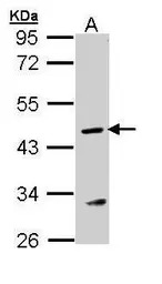 ASL antibody