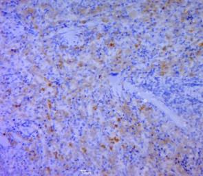 CD5L antibody