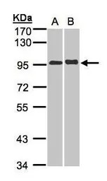 IL12 Receptor beta2 antibody [