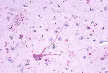 Leukotriene B4 Receptor antibo