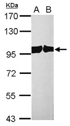 CSE1L antibody