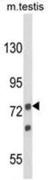 ANGEL1 antibody, C-term