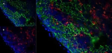 Marco antibody [ED31]
