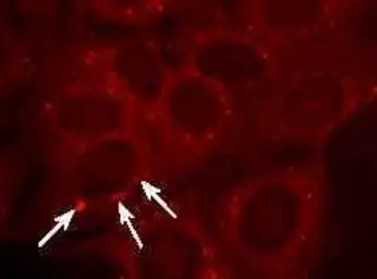 TCR gamma + delta antibody [GL