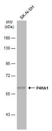 P4HA1 antibody [C1C3]