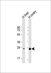 Neurotrophin 3 antibody, C-ter