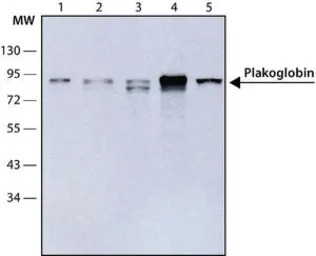 gamma Catenin antibody [15F11]