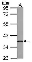 DKK3 antibody [N2C3]