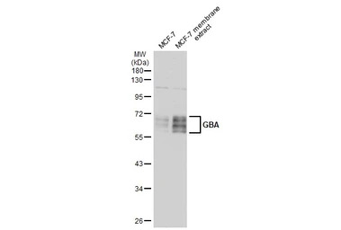 GBA antibody