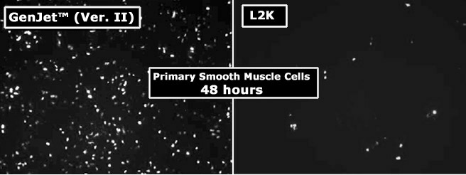 进口GenJet™体外DNA转染试剂(Ver. II)