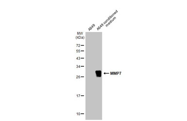 MMP7 antibody [C2C3], C-term