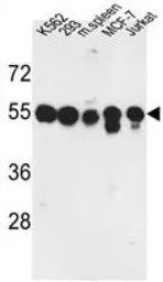 PPM1H antibody, Internal
