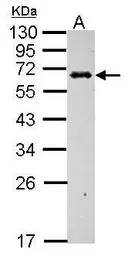 C4 binding protein B antibody