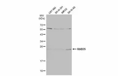 RAB35 antibody [N1C3]