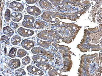 alpha Adducin antibody