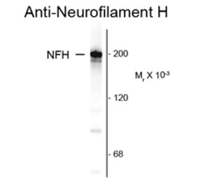 NF-H antibody [NAP4]