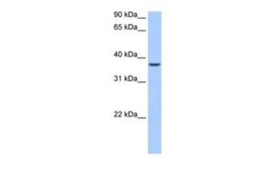 ALKBH8 antibody, N-term
