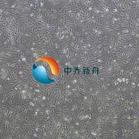 人Ⅱ型肺泡上皮细胞-永生化 