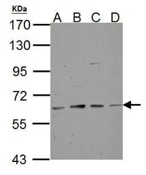 Tyrosine Hydroxylase antibody