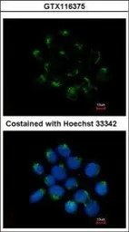 CNDP2 antibody [N3C3]
