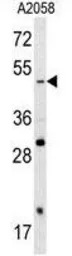 SOX4 antibody, N-term