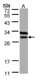 ETFB antibody [N1C3]