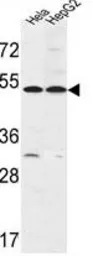 FERMT1 antibody, Internal