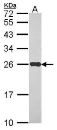 NDUFS8 antibody