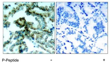 PKC beta 2 (phospho Thr641) an