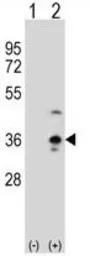 COLEC11 antibody, N-term