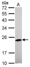 Phosphatase orphan 2 antibody 