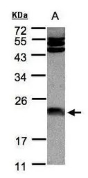 Ferritin Light Chain antibody 