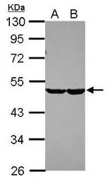 CHST7 antibody [N2C1], Interna
