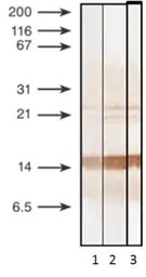 Procalcitonin antibody [27A3]