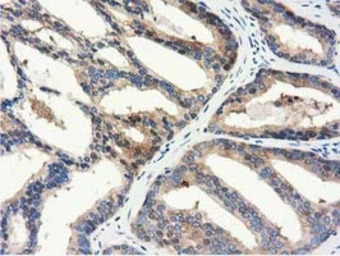 ALDH1L1 antibody [6A10]