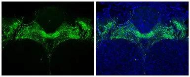 Tyrosine Hydroxylase antibody