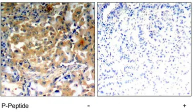 PKC zeta (phospho Thr410) anti